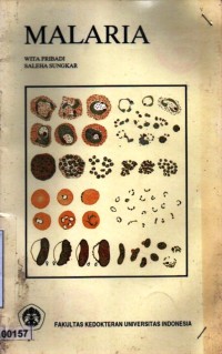 Image of Malaria
